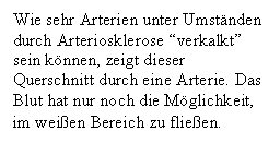 Text Box: Wie sehr Arterien unter Umstnden durch Arteriosklerose 